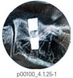osteointegration-img-small osteointegration-img-small
